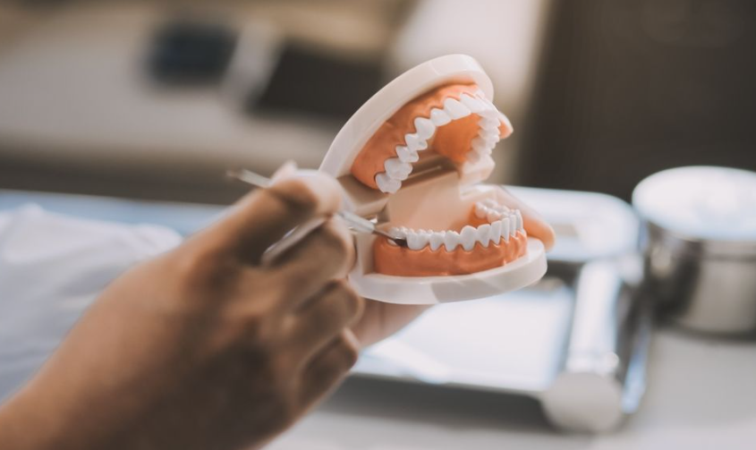 How Do I Clean and Care for a Removable Dental Bridge?